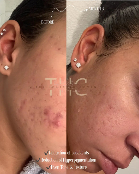 Rose Gold Elixir: Calming Skin Oil for Glow, Hydration & Redness Relief My Store