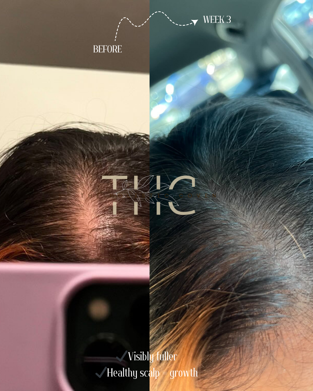 Herbal Hair Growth Oil: Bhringraj & Rosemary Herbal Hair Oil for Visibly Thicker, Fuller Growth