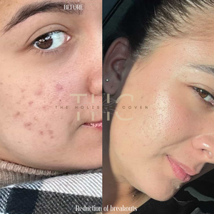 Rose Gold Elixir: Calming Face Oil for Glow, Hydration & Redness Relief