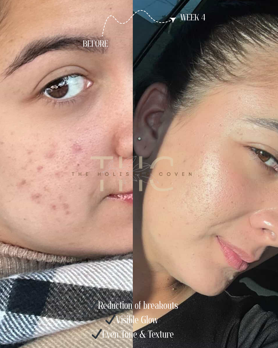 Rose Gold Elixir: Calming Face Oil for Glow, Hydration & Redness Relief