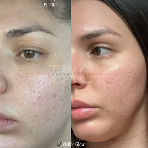 Rose Gold Elixir: Calming Face Oil for Glow, Hydration & Redness Relief