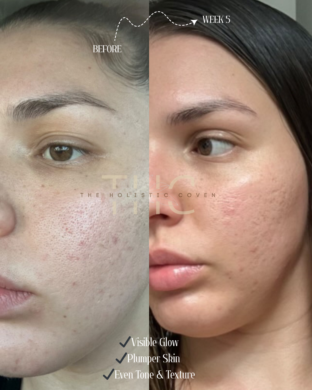 Rose Gold Elixir: Calming Face Oil for Glow, Hydration & Redness Relief