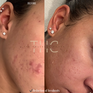 Rose Gold Elixir: Calming Face Oil for Glow, Hydration & Redness Relief