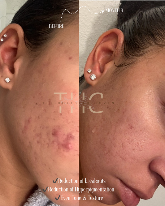 Rose Gold Elixir: Calming Face Oil for Glow, Hydration & Redness Relief