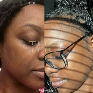 Rose Gold Elixir: Calming Face Oil for Glow, Hydration & Redness Relief