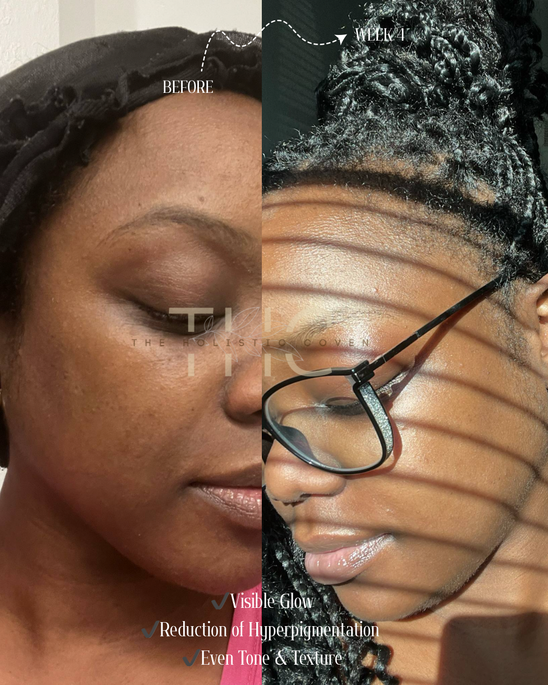 Rose Gold Elixir: Calming Face Oil for Glow, Hydration & Redness Relief