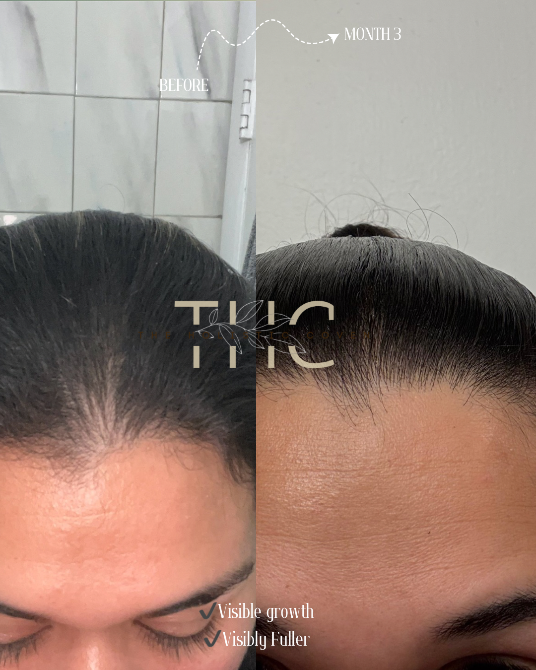 Herbal Hair Growth Oil: Bhringraj & Rosemary Herbal Hair Oil for Visibly Thicker, Fuller Growth