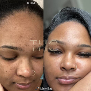 Rose Gold Elixir: Calming Face Oil for Glow, Hydration & Redness Relief