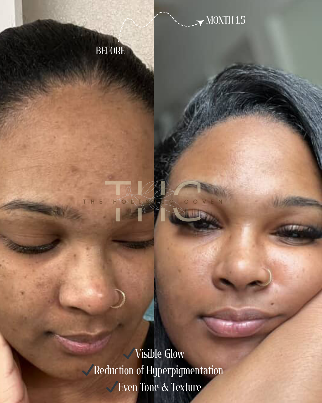 Rose Gold Elixir: Calming Face Oil for Glow, Hydration & Redness Relief