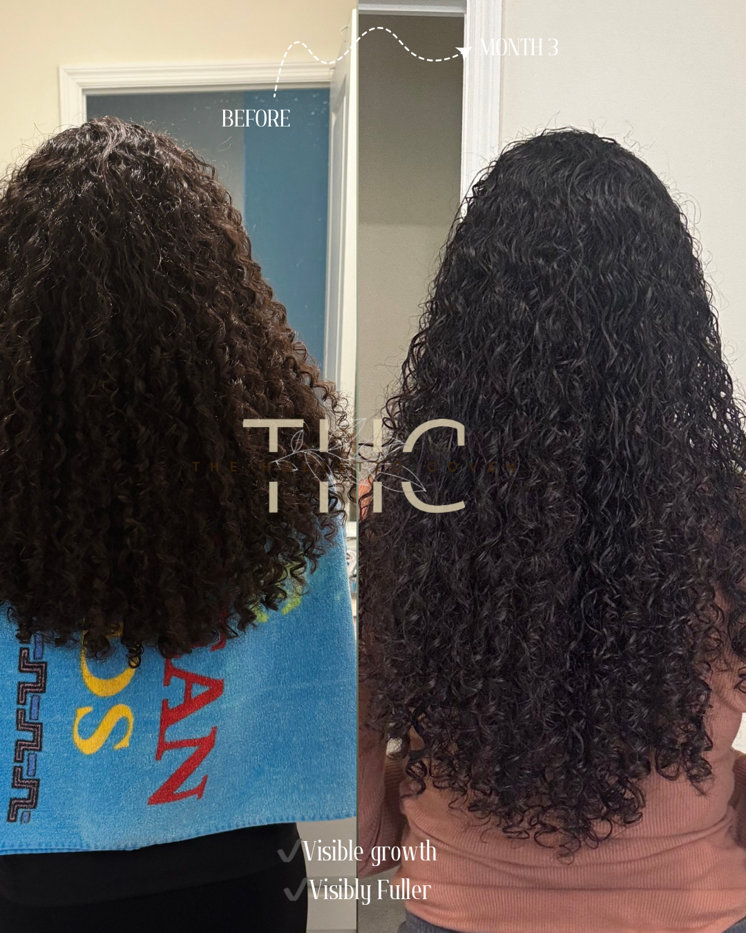 Herbal Hair Growth Oil: Bhringraj & Rosemary Herbal Hair Oil for Visibly Thicker, Fuller Growth